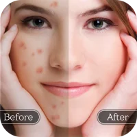 Face Blemish Remover - Smooth
